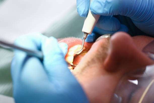 Best Emergency Dental Surgery in York, AL
