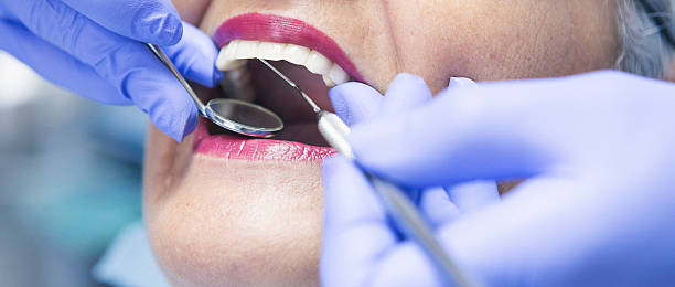 Best Emergency Wisdom Teeth Removal in York, AL