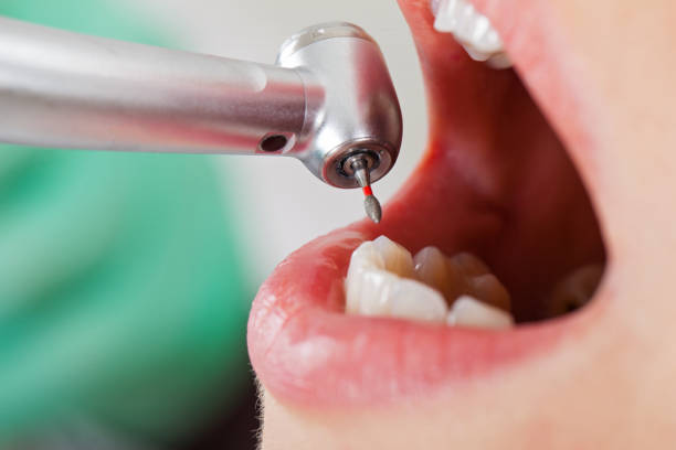 Best Emergency Dental Surgery in York, AL